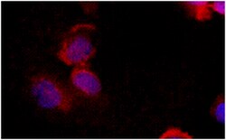 LRAT Mouse anti-Human, Mouse, Rat, Clone: M34-P1F10, MilliporeSigma 100 &mu;g | Buy Online | MilliporeSigma | Fisher Scientific